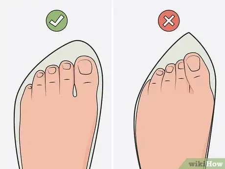 Imagen titulada Heal a Bruised Toenail Quickly Step 17