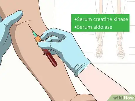 Imagen titulada Diagnose Muscular Dystrophy Step 10