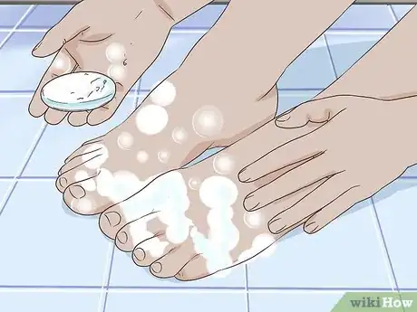 Imagen titulada Remove Stains from Your Feet Step 2