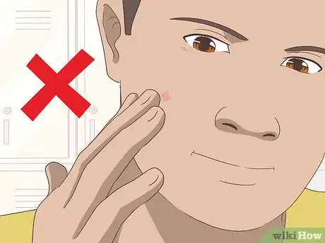 Imagen titulada Stop a Pimple from Forming Step 7
