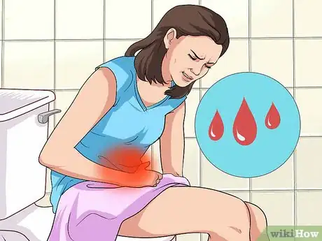 Imagen titulada Identify Signs of Secondary Dysmenorrhea Step 7