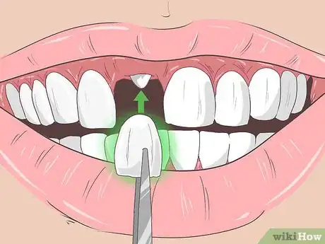 Imagen titulada Remove Brown Stains from Teeth Step 10