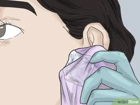 Imagen titulada Pierce Your Ear with a Safety Pin Step 6