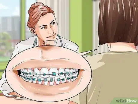 Imagen titulada Connect a Rubber Band to Your Braces Step 1