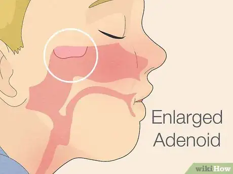 Imagen titulada Make Saline Nasal Spray Step 22