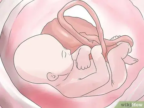 Imagen titulada Prepare for a Cesarean Section Step 18