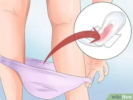 Imagen titulada Stop Vaginal Bleeding During Pregnancy Step 1