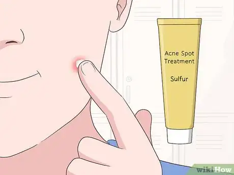 Imagen titulada Shrink Pimples Step 7