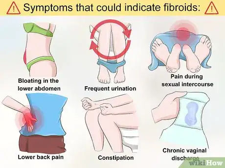 Imagen titulada Diagnose Uterine Fibroids Step 2