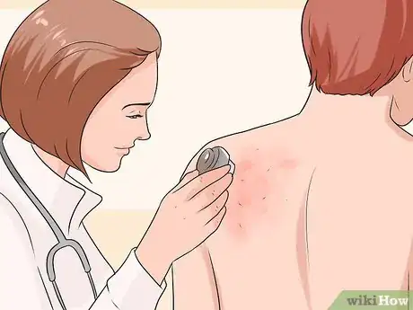 Imagen titulada Treat Bed Bug Bites Step 4