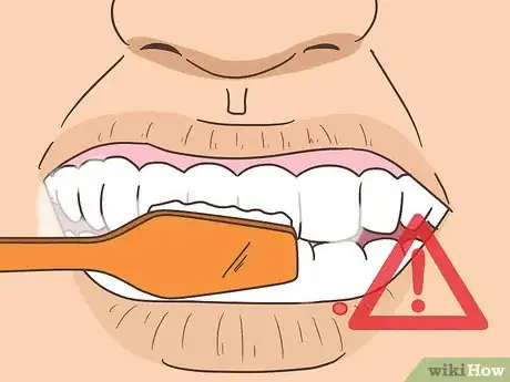 Imagen titulada Remove a Mouth Ulcer Step 11