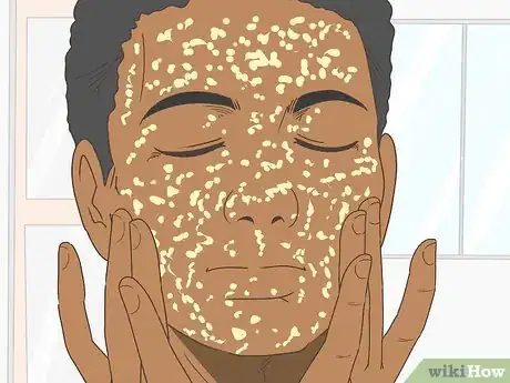 Imagen titulada Make a Honey and Sugar Face Scrub Step 13