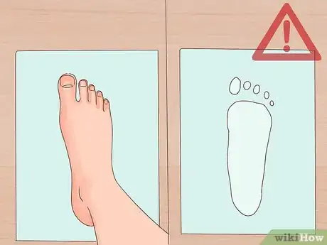 Imagen titulada Fix Pronated Feet Step 14