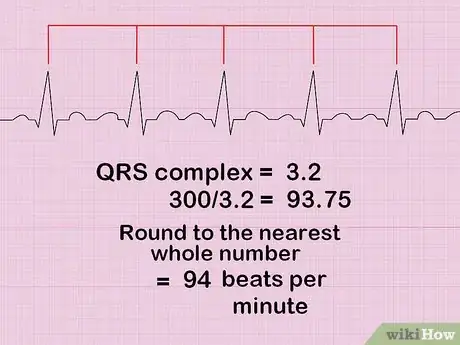 Imagen titulada Calculate Heart Rate from ECG Step 4