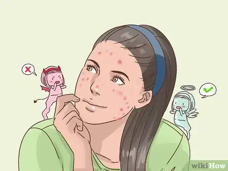 Imagen titulada Deal with the Effect of Acne on Self Esteem Step 1