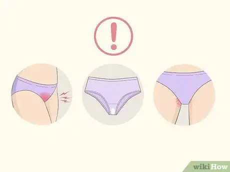 Imagen titulada Get Rid of a Yeast Infection at Home Step 1