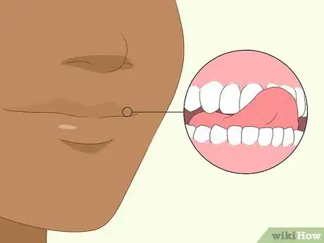 Imagen titulada Fix an Uneven Smile Step 11