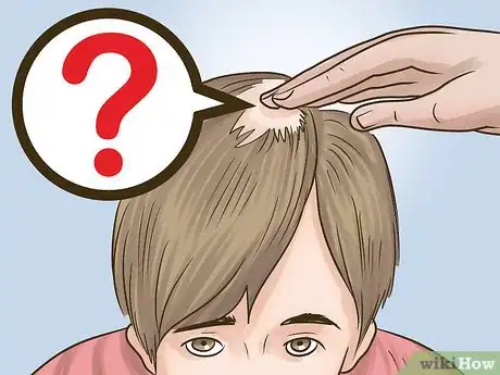 Imagen titulada Stop Hair Loss in Children Step 2