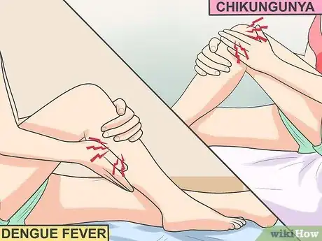 Imagen titulada Ease Muscle Pain from Chikungunya Step 3