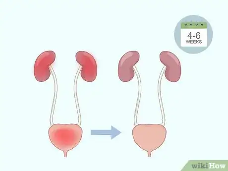 Imagen titulada Do Kegel Exercises Step 14