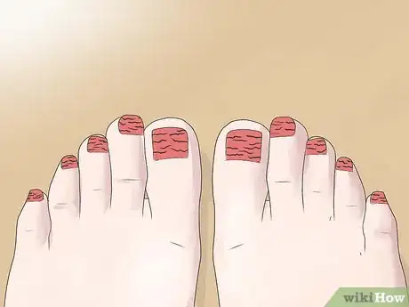 Imagen titulada Perform a Professional Salon Pedicure Step 18