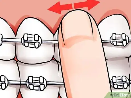 Imagen titulada Apply Dental Wax on Braces Step 8