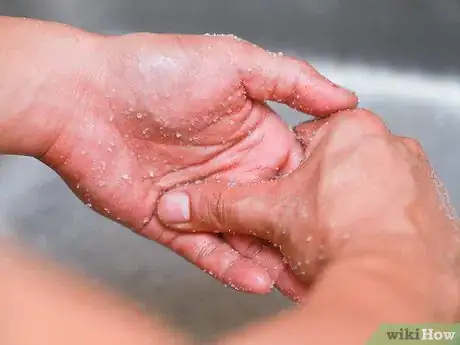 Imagen titulada Get Super Glue off of Your Hands with Salt Step 5