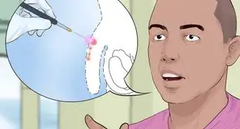 curar verrugas genitales en hombres