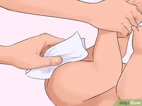 Imagen titulada Help a Male Child Provide a Urine Sample Step 22