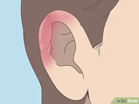 Imagen titulada Pierce Your Own Cartilage Step 13