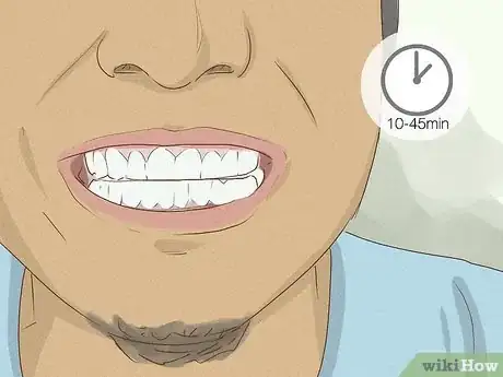 Imagen titulada Get Whiter Teeth at Home Step 4