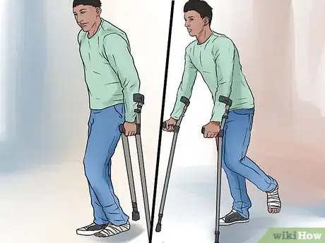Imagen titulada Walk on Crutches Step 15