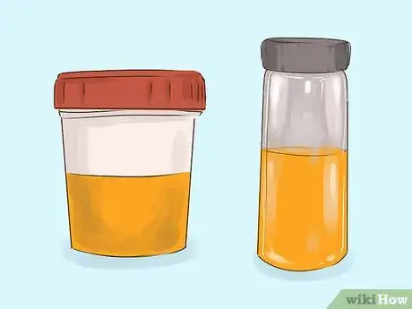 Imagen titulada Store Urine for a Drug Test Step 2