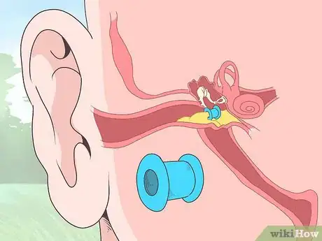 Imagen titulada Tell if You Have an Ear Infection Step 16