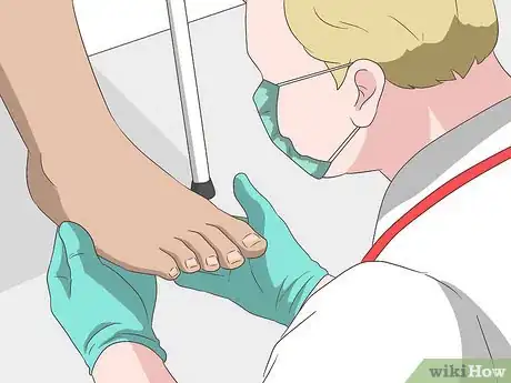 Imagen titulada Treat Toe Nail Fungus Step 8