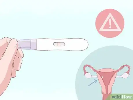 Imagen titulada Identify Abnormal Vaginal Spotting Between Periods Step 8