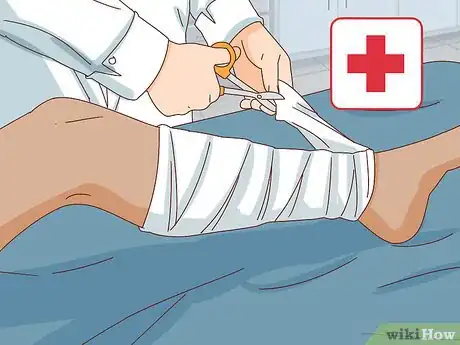 Imagen titulada Stop Bleeding when on Blood Thinners Step 5