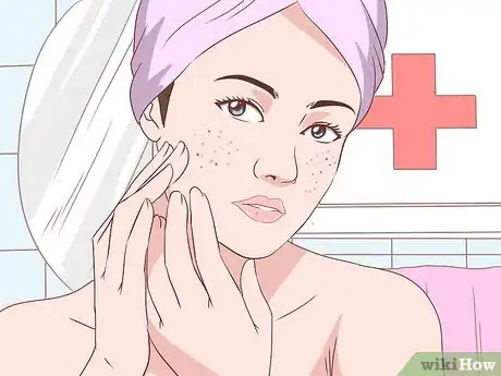 Imagen titulada Get Rid of Acne Without Using Medication Step 35