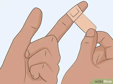 Imagen titulada Treat a Hot Glue Burn Step 10