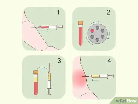 Imagen titulada Treat Bicep Tendonitis Step 11