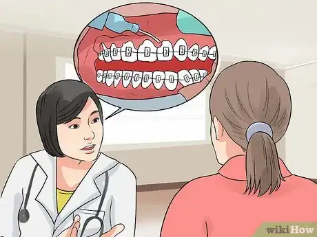 Imagen titulada Prepare for the Day That You Get Braces Step 10