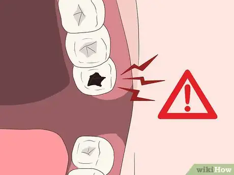 Imagen titulada Cure a Toothache Step 6