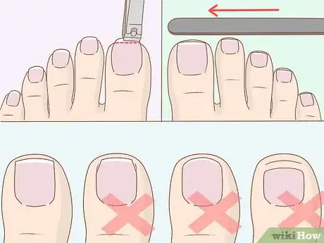 Imagen titulada Get Healthy, Clean and Good Looking Feet Step 5