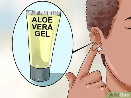 Imagen titulada Get Rid of Pimples Inside the Ear Step 13