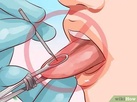 Imagen titulada Do a Self Piercing at Home Step 11