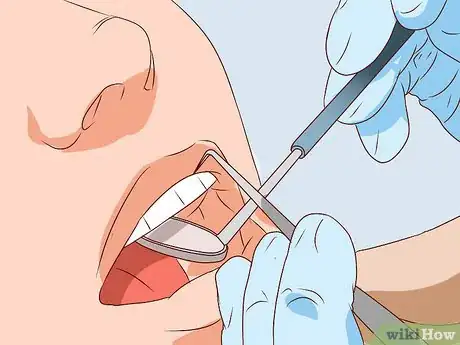 Imagen titulada Stop Tooth Nerve Pain Step 4