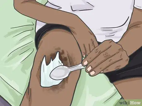 Imagen titulada Bleach Skin with Peroxide Step 18