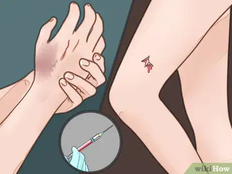 Imagen titulada Know when You Need a Tetanus Shot Step 1