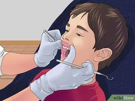 Imagen titulada Stop the Bleeding After You Pull out a Loose Tooth Step 7