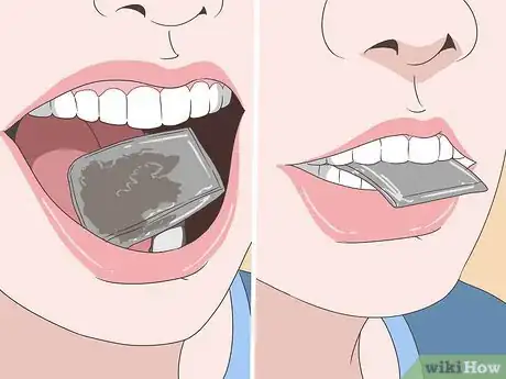 Imagen titulada Reduce Wisdom Tooth Swelling Step 4